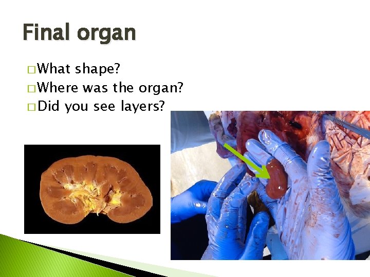 Final organ � What shape? � Where was the organ? � Did you see