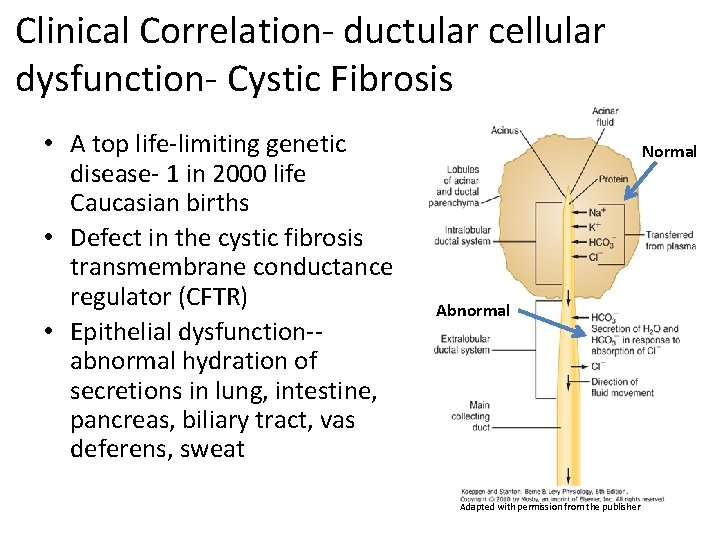 Clinical Correlation- ductular cellular dysfunction- Cystic Fibrosis • A top life-limiting genetic disease- 1
