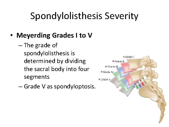 Spondylolisthesis Severity • Meyerding Grades I to V – The grade of spondylolisthesis is