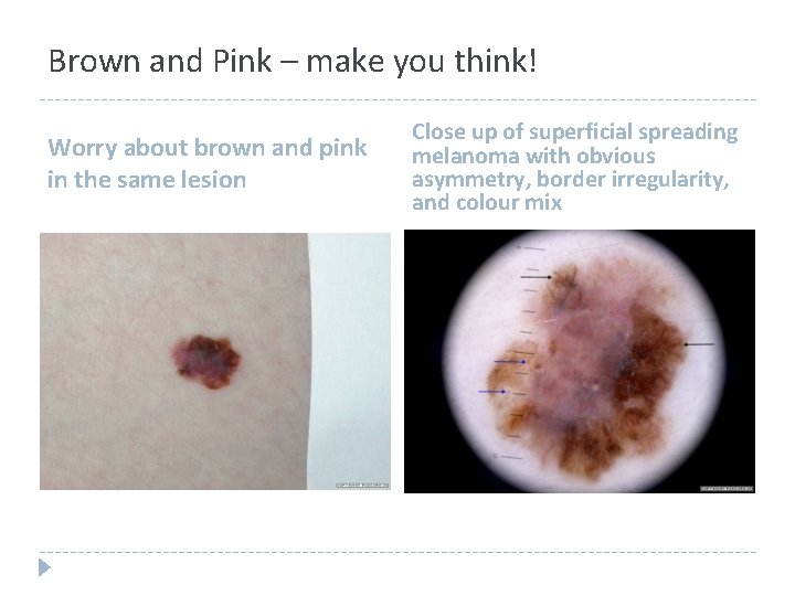 Brown and Pink – make you think! Worry about brown and pink in the Brown and Pink – make you think! Worry about brown and pink in the