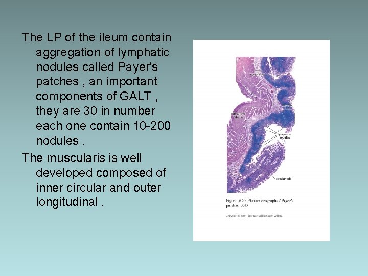 The LP of the ileum contain aggregation of lymphatic nodules called Payer's patches ,