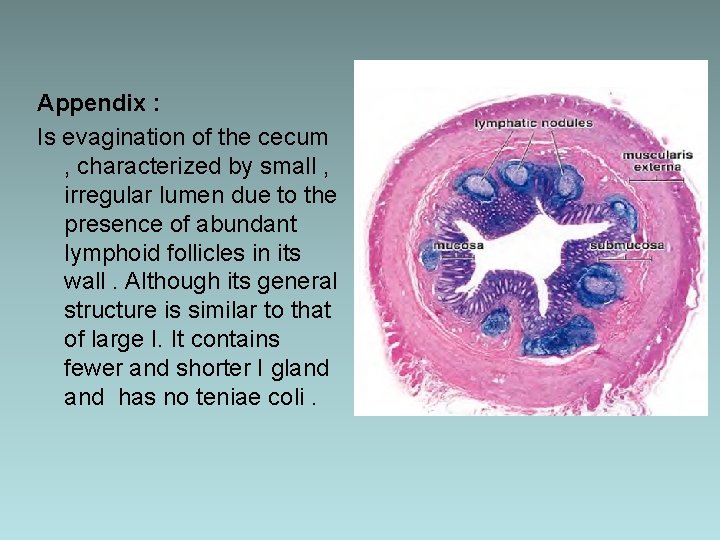 Appendix : Is evagination of the cecum , characterized by small , irregular lumen