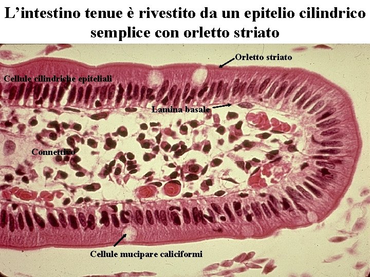 L’intestino tenue è rivestito da un epitelio cilindrico semplice con orletto striato Orletto striato