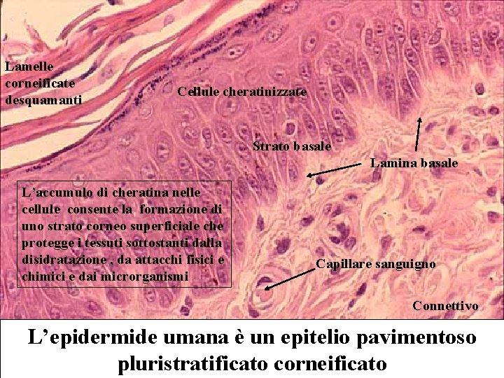 Lamelle corneificate desquamanti Cellule cheratinizzate Strato basale Lamina basale L’accumulo di cheratina nelle cellule