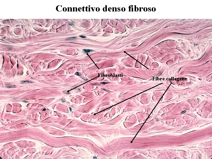 Connettivo denso fibroso Fibroblasti Fibre collagene 