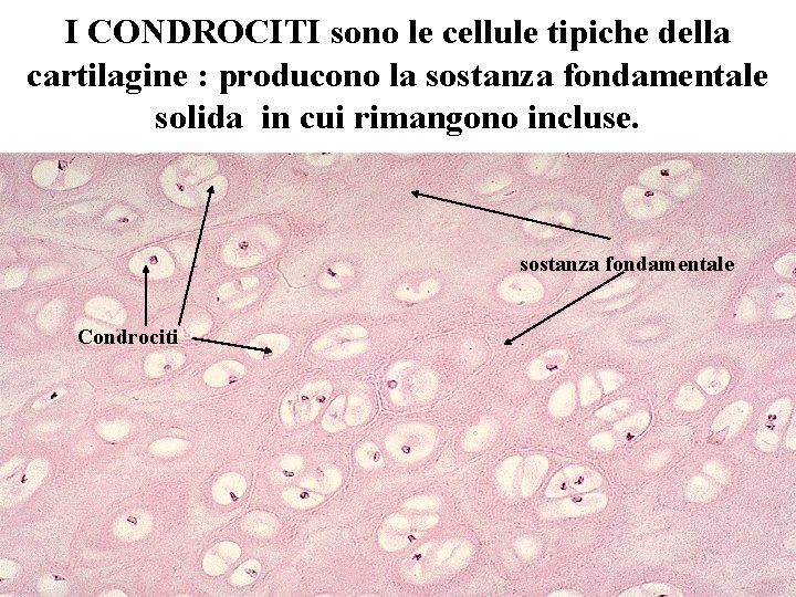 I CONDROCITI sono le cellule tipiche della cartilagine : producono la sostanza fondamentale solida