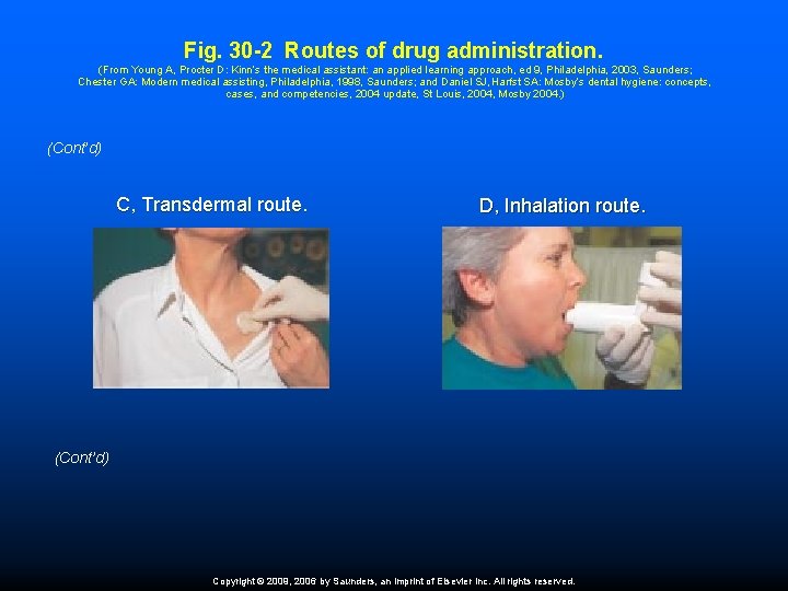 Fig. 30 -2 Routes of drug administration. (From Young A, Procter D: Kinn’s the