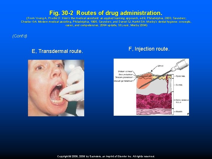Fig. 30 -2 Routes of drug administration. (From Young A, Procter D: Kinn’s the