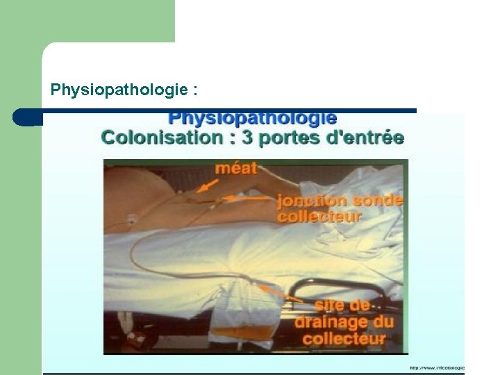 Physiopathologie : 
