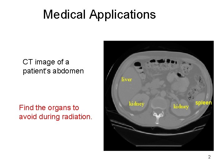 Medical Applications CT image of a patient’s abdomen liver Find the organs to avoid Medical Applications CT image of a patient’s abdomen liver Find the organs to avoid