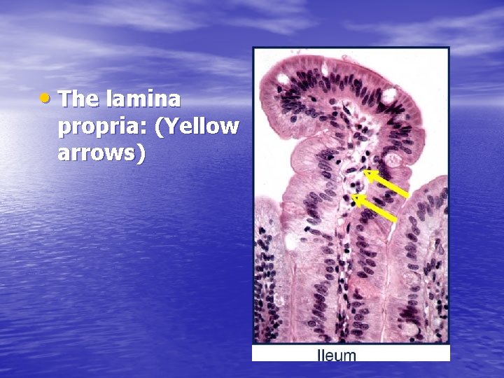 • The lamina propria: (Yellow arrows) 