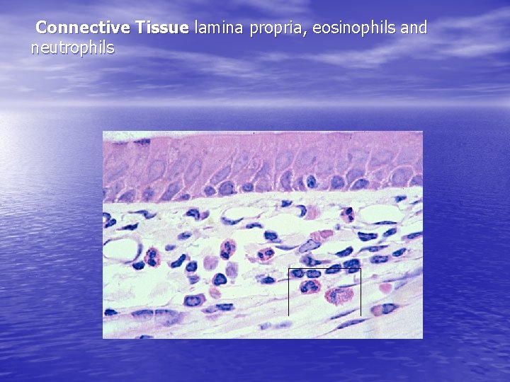 Connective Tissue lamina propria, eosinophils and neutrophils 