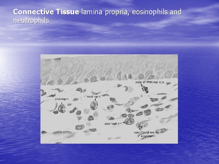 Connective Tissue lamina propria, eosinophils and neutrophils 