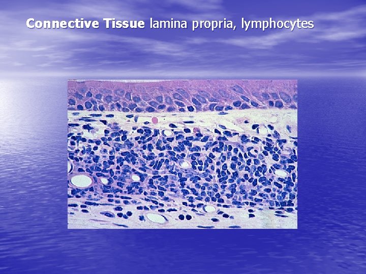 Connective Tissue lamina propria, lymphocytes 