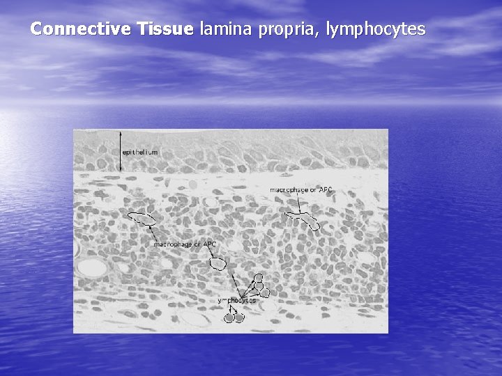 Connective Tissue lamina propria, lymphocytes 