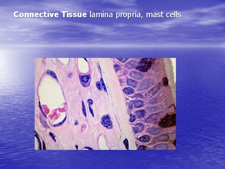 Connective Tissue lamina propria, mast cells 