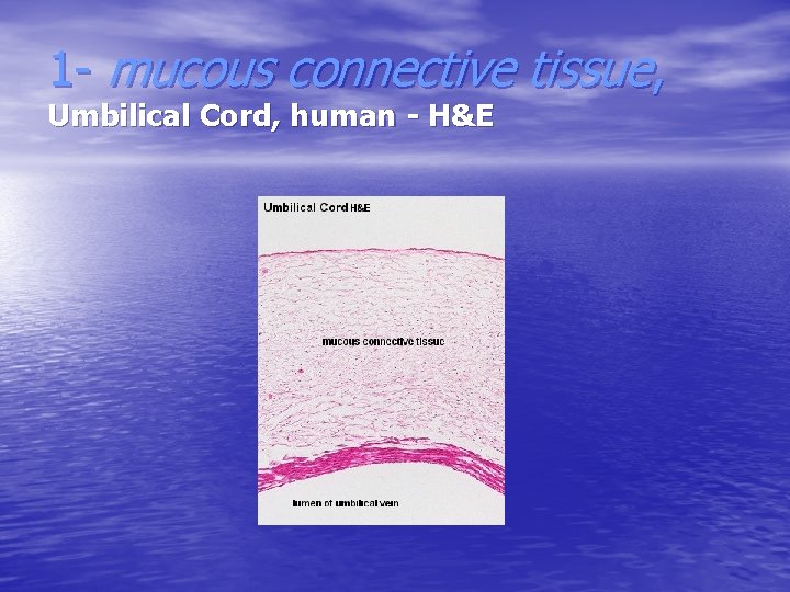 1 - mucous connective tissue, Umbilical Cord, human - H&E 