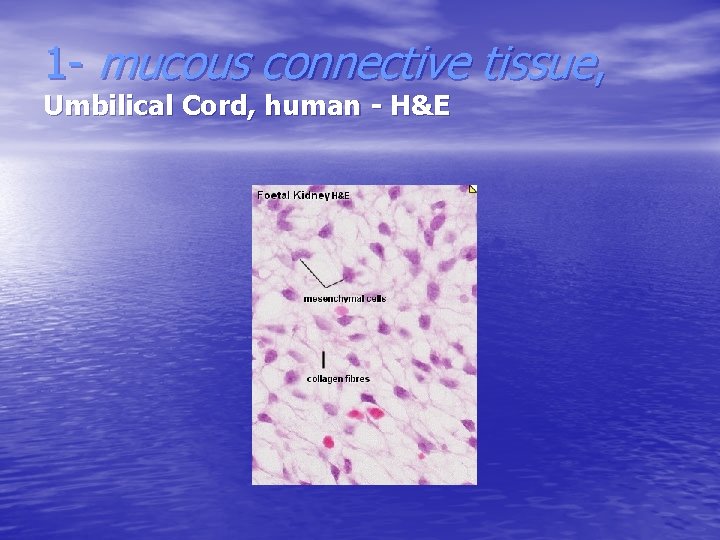 1 - mucous connective tissue, Umbilical Cord, human - H&E 