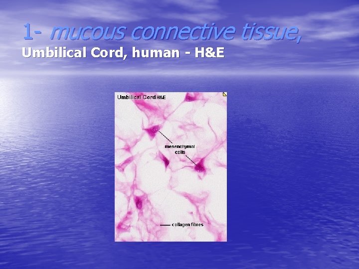 1 - mucous connective tissue, Umbilical Cord, human - H&E 