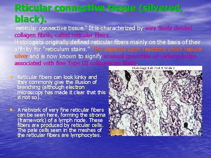 Rticular connective tissue (silvered, black). reticular connective tissue. " It is characterized by very