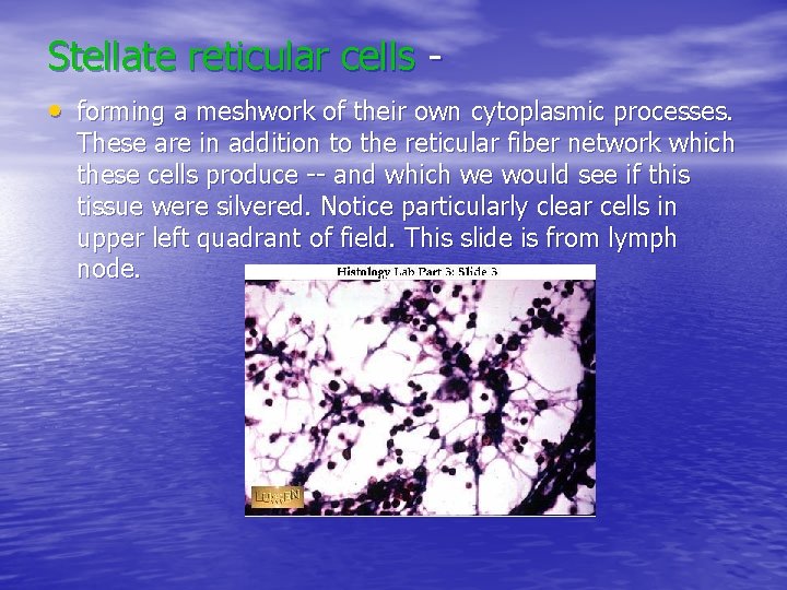 Stellate reticular cells • forming a meshwork of their own cytoplasmic processes. These are