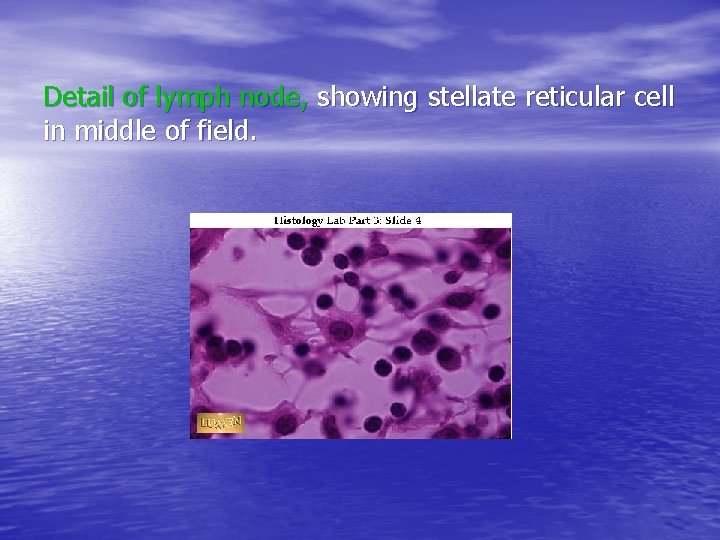 Detail of lymph node, showing stellate reticular cell in middle of field. 