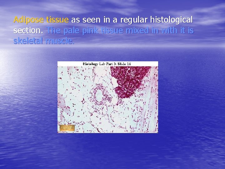 Adipose tissue as seen in a regular histological section. The pale pink tissue mixed