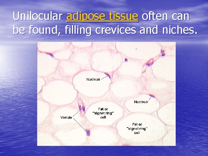 Unilocular adipose tissue often can be found, filling crevices and niches. 