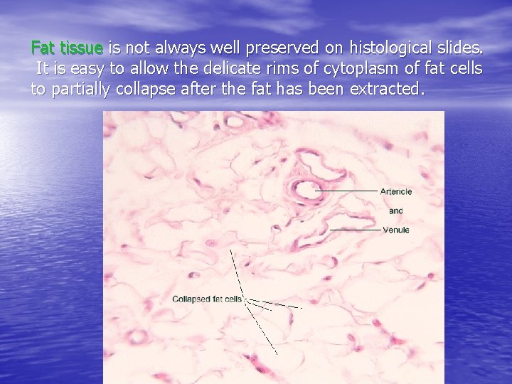 Fat tissue is not always well preserved on histological slides. It is easy to