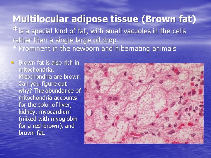 Multilocular adipose tissue (Brown fat) *is a special kind of fat, with small vacuoles