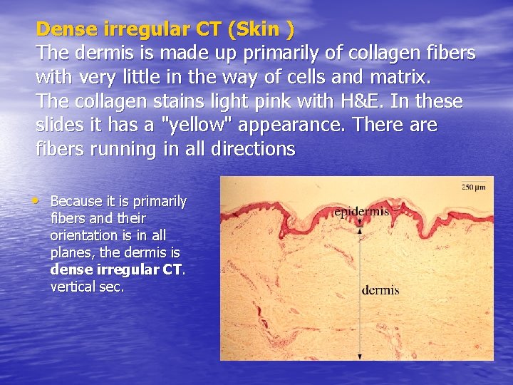 Dense irregular CT (Skin ) The dermis is made up primarily of collagen fibers