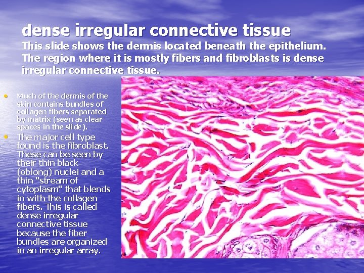 dense irregular connective tissue This slide shows the dermis located beneath the epithelium. The