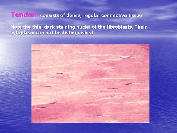 Tendon consists of dense, regular connective tissue. Note thin, dark staining nuclei of the