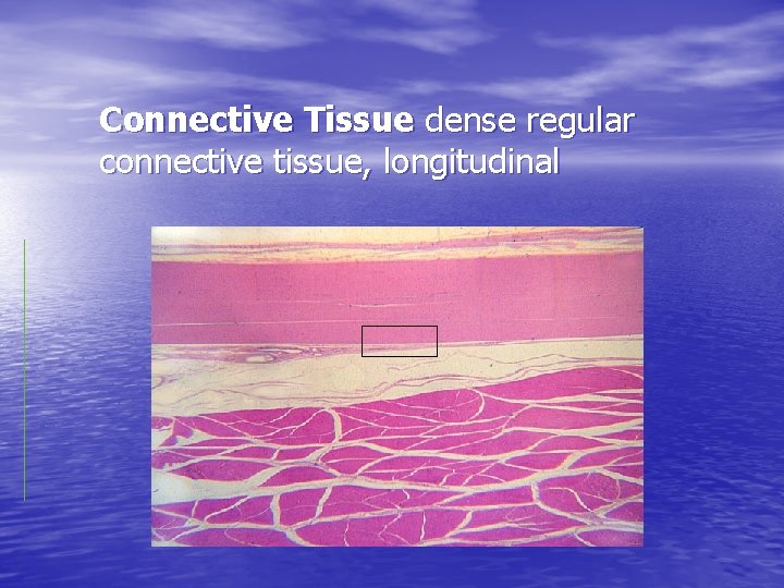 Connective Tissue dense regular connective tissue, longitudinal 