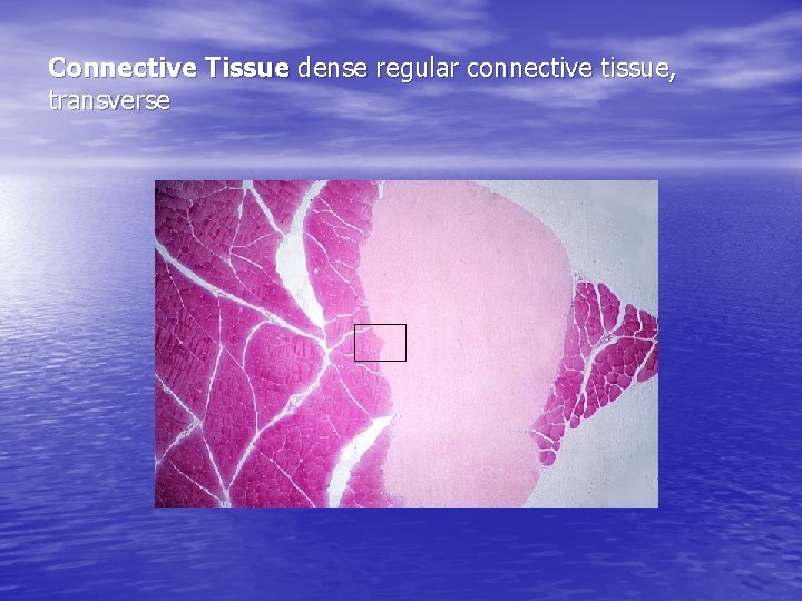 Connective Tissue dense regular connective tissue, transverse 
