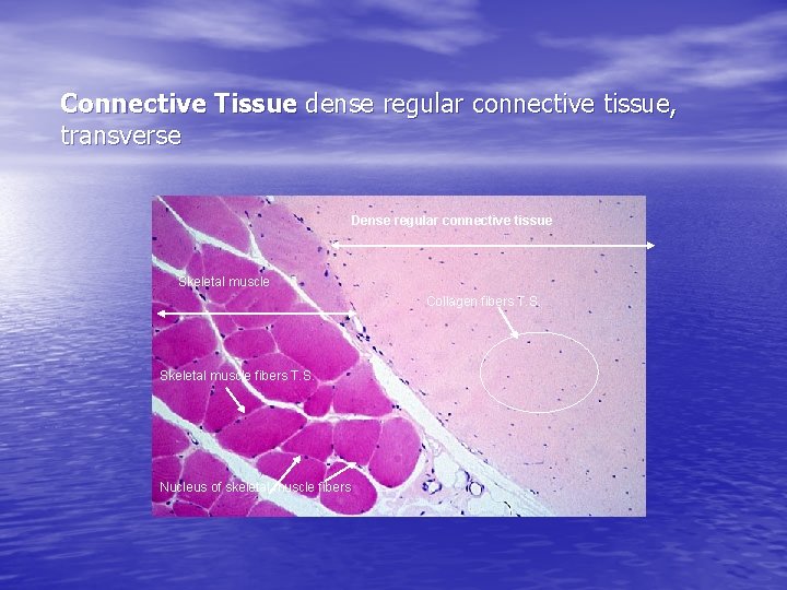 Connective Tissue dense regular connective tissue, transverse Dense regular connective tissue Skeletal muscle Collagen