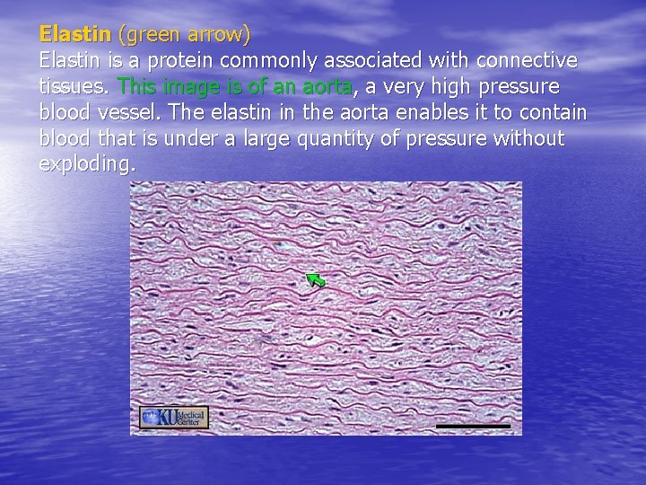 Elastin (green arrow) Elastin is a protein commonly associated with connective tissues. This image