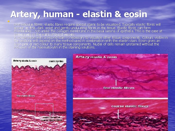  • Artery, human - elastin & eosin Like reticular fibres, elastic fibres require