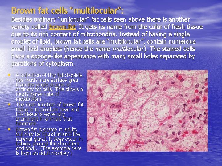 Brown fat cells “multilocular”: Besides ordinary "unilocular" fat cells seen above there is another
