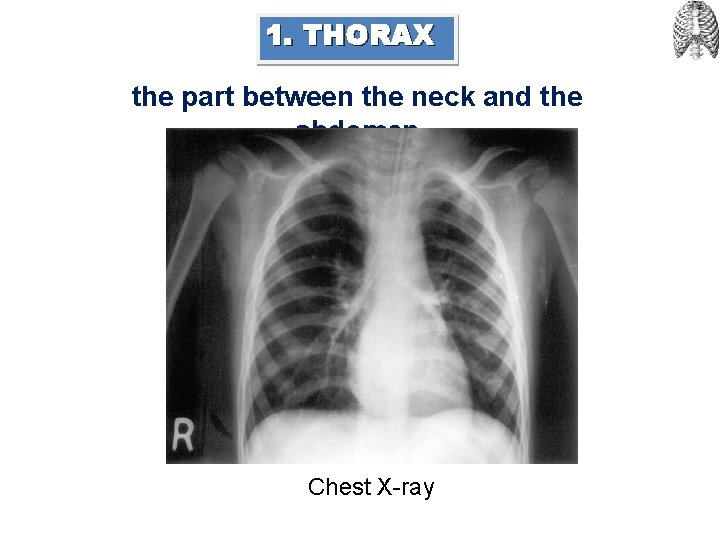 1. THORAX the part between the neck and the abdomen Chest X-ray 