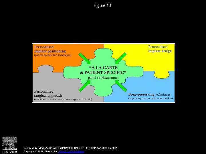 Figure 13 Seminars in Arthroplasty: JSES 2018 29330 -343 DOI: (10. 1053/j. sart. 2019.