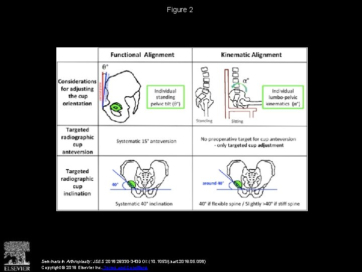 Figure 2 Seminars in Arthroplasty: JSES 2018 29330 -343 DOI: (10. 1053/j. sart. 2019.