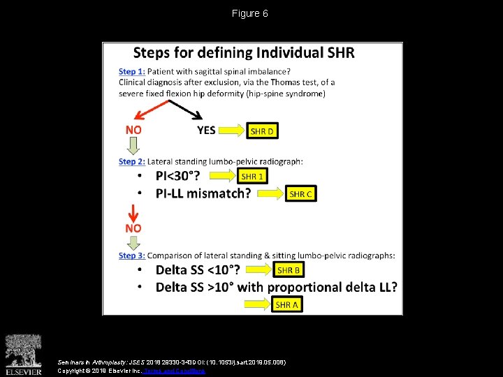 Figure 6 Seminars in Arthroplasty: JSES 2018 29330 -343 DOI: (10. 1053/j. sart. 2019.