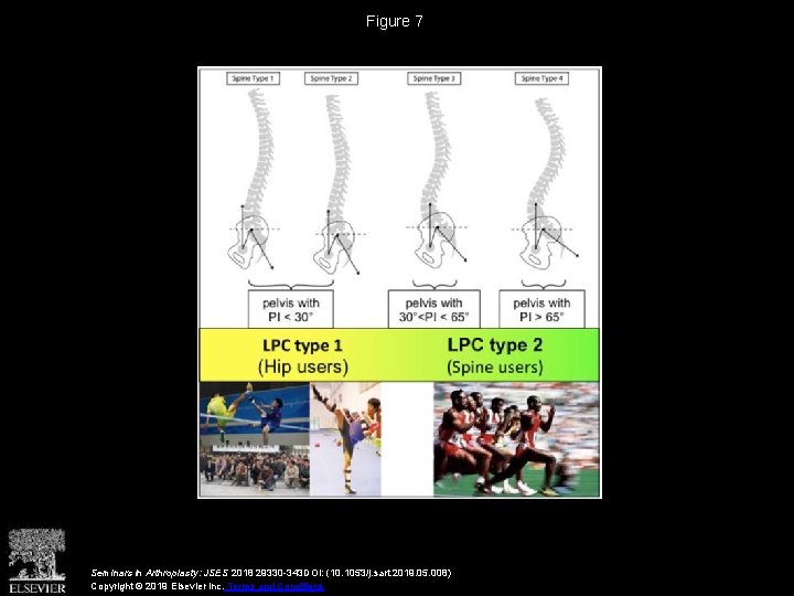 Figure 7 Seminars in Arthroplasty: JSES 2018 29330 -343 DOI: (10. 1053/j. sart. 2019.