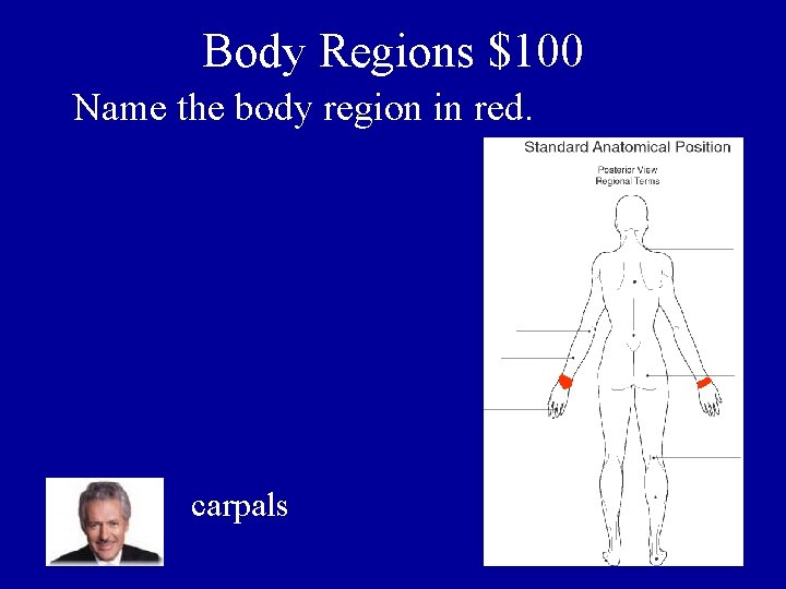 Body Regions $100 Name the body region in red. carpals 