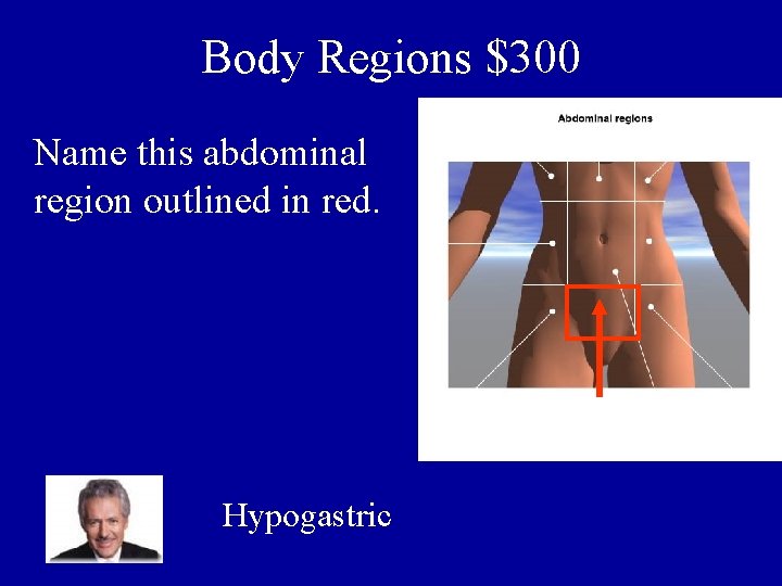 Body Regions $300 Name this abdominal region outlined in red. Hypogastric 
