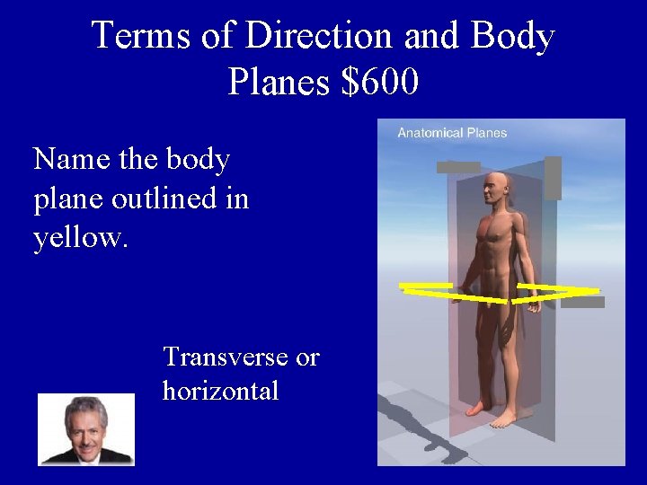 Terms of Direction and Body Planes $600 Name the body plane outlined in yellow.