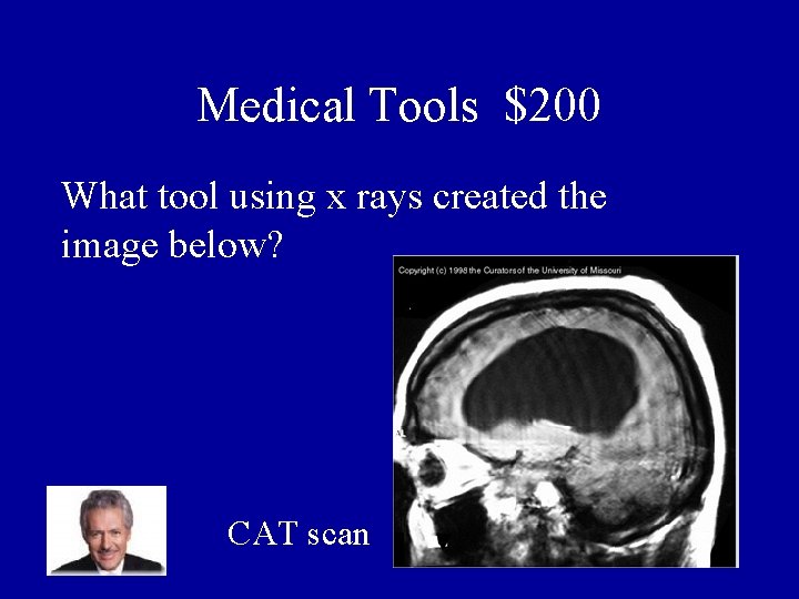 Medical Tools $200 What tool using x rays created the image below? CAT scan