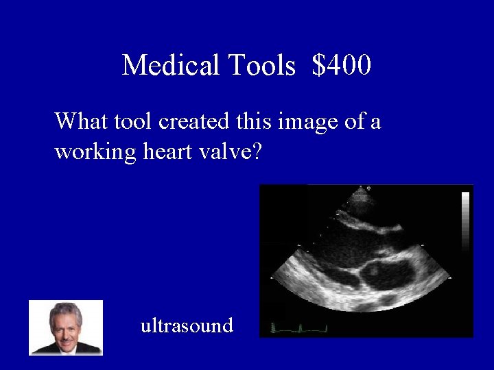 Medical Tools $400 What tool created this image of a working heart valve? ultrasound