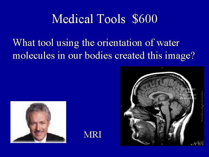 Medical Tools $600 What tool using the orientation of water molecules in our bodies